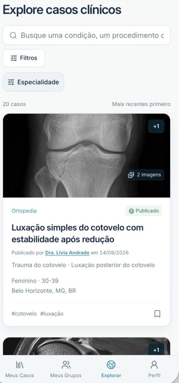 Tela atual de Explorar com busca, filtros e casos publicados por outros médicos